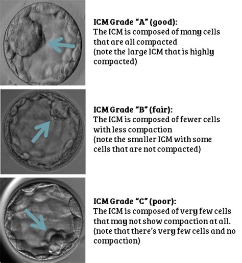 Embryo grading for Day 3 & Day 5 embryos: your questions answered