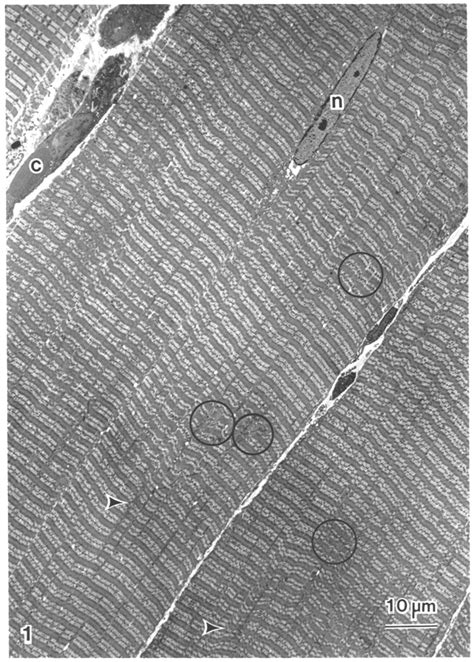 Electron Micrograph Of Longitudinally Sectioned Muscle Fibre After