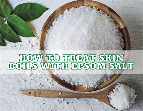 How To Get Rid Of Boils With Epsom Salt 2023 Complete Guide