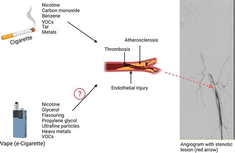 Frontiers A Modern Day Perspective On Smoking In Peripheral Artery