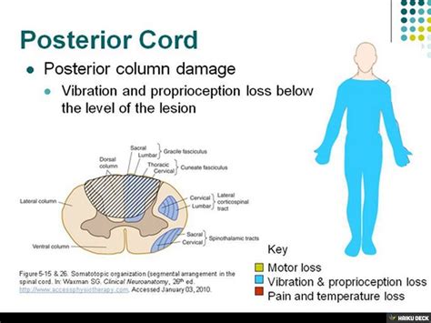 Posterior cord syndrome