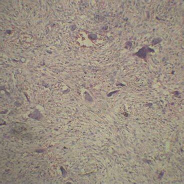 Photomicrograph Showing Loosely Arranged Fibrocellular Connective