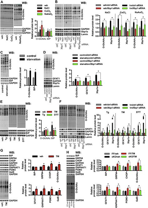 Spliced X Box Binding Protein 1 Couples The Unfolded Protein Response