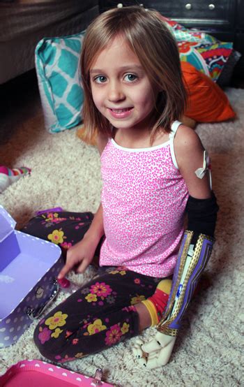 7yo Receives 3d Printed Bionic Arm 3d Printing Industry