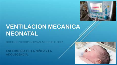 Ventilaci N Mec Nica Neonatal Jade Udocz