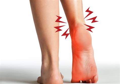 Podiatrists For Achilles Tendon In Saddle Ridge Calgary