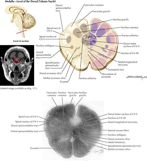 Brainstem and Cerebellum - Clinical Tree