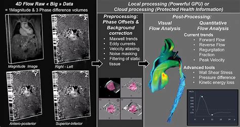 Four Dimensional Flow Mri Principles And Cardiovascular Applications