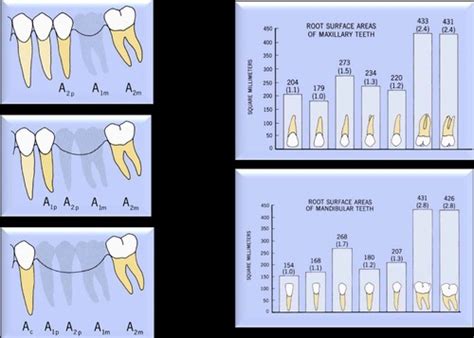 Fpd Abutment Selection Flashcards Quizlet