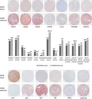 Tyrosine Kinase Receptors As Molecular Targets In Pheochromocytomas And