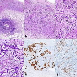 Histological And Immunohistochemical Findings A Scanner View Of