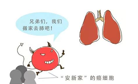 转移性癌症：癌症扩散转移，究竟意味着什么？ 好医友