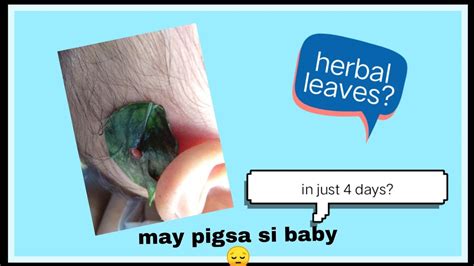 Herbal Leaves Para Sa Pigsa Ni Baby Effective Nga Ba Youtube