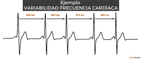 Qué es la variabilidad de la frecuencia cardiaca Quora