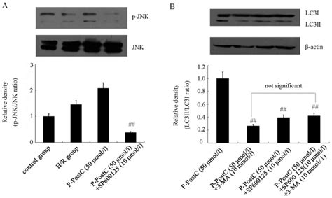 Propofol Postconditioning Protects H C Cells From Hypoxia