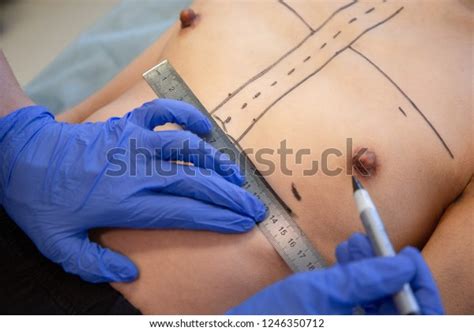 Plastic Surgery Closeup Naked Woman Body Stock Photo