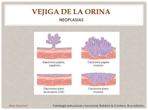 Vias Urinarias Bajas Y Aparato Genital Masculino Ppt