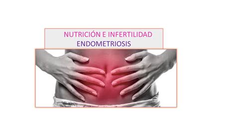 Endometriosis Nutrición Lorca