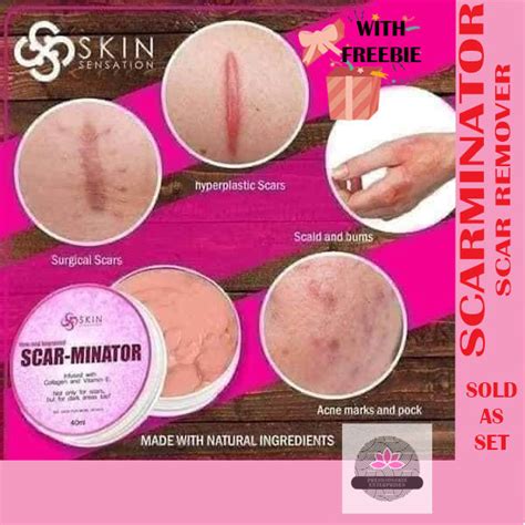 Original Scarminator Scar And Keloids Remover Lazada Ph