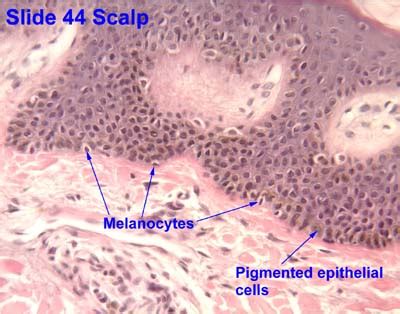 Melanocyte Histology