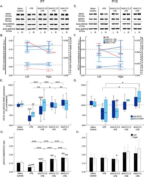 KCC2 And PKCC2 S940 Expression 24 H Post Ischemia A E