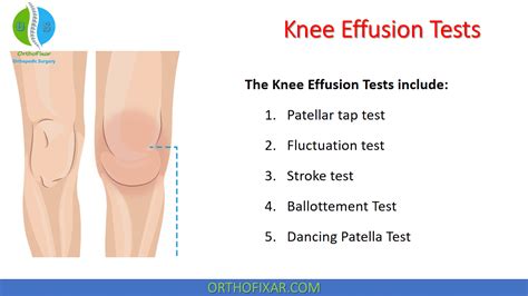 Youmna Mrad What Is Knee Effusion? ?? When A Joint Is, 56% OFF