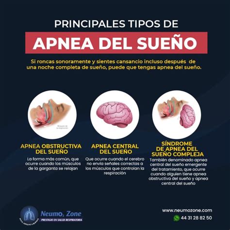 Apnea Del Sue O Tipos S Ntomas Causas Factores De Riesgo