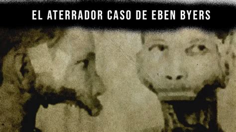 El Aterrador Caso De Eben Byers El Hombre Sin Mand Bula Youtube