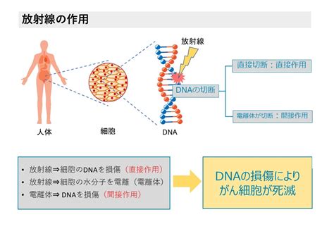 放射線治療は“がん治療の三本柱”の1つ｜放射線アカデミア