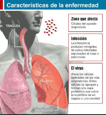 Asmáticos Preguntas frecuentes sobre el Neumococo