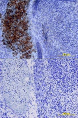 Mouse SOST/Sclerostin Biotinylated Antibody BAF1589: R&D Systems