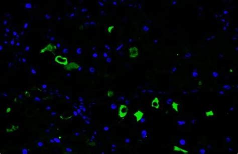 Cxcl13 Recombinant Rabbit Monoclonal Antibody Hl2172 Invitrogen 100