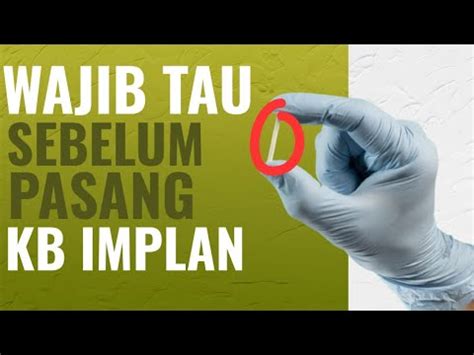 Efek Samping Kb Implan Kb Susuk Yang Perlu Diketahui Info