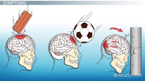 Blunt Force Trauma Definition Symptoms Examples Lesson Study