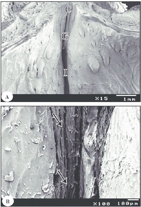 Scanning Electron Micrograph Of Higher Magnification Of Pharyngeal