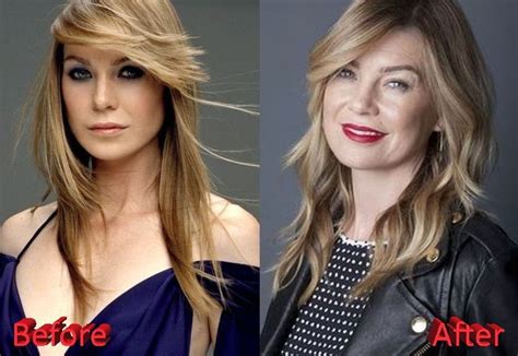 Ellen Pompeo before and after plastic surgery (9) – Celebrity plastic ...