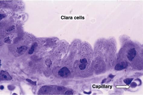 Pin On Histology Respiratory