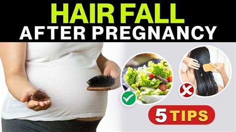 5 Tips To Control Hair Fall After Pregnancy Stop Postpartum Hair Loss Youtube