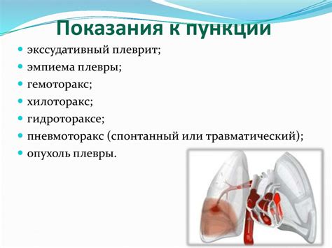 Плевральная и люмбальная пункция - презентация онлайн
