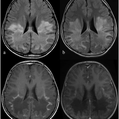 Magnetic Resonance Imaging Mri Data A Initial Cerebral Mri Cmri