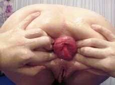 Anal Prolapse Porn Pornhub