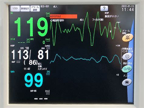 Bedside Monitor PVM 2701 NIHON KOHDEN Used Medical Equipment Supplier