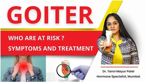 Goiter Understanding The Risks Symptoms And Treatment Options By Dr Tanvi Mayur Patel Youtube