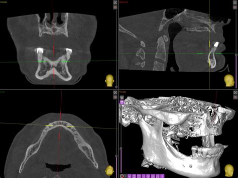 Dental Implants Tan Khuu Dds