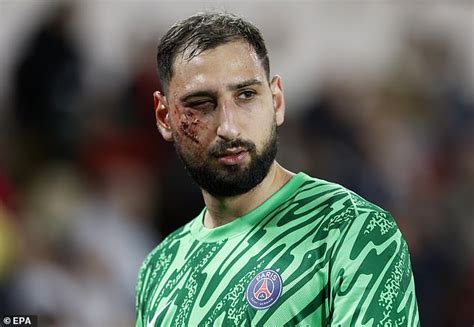 Gianluigi Donnarumma Provides Two Word Update As PSG Star Shares New