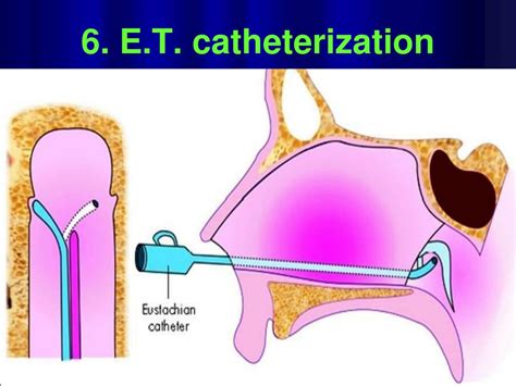 Ppt Anatomy And Physiology Of Eustachian Tube Powerpoint Presentation