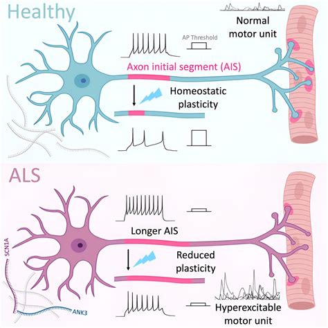 Specialized Motor Neuron Region Affected In Amyotrophic Lateral