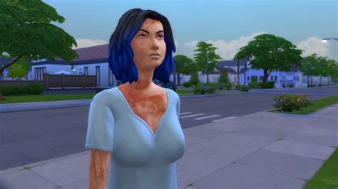 Sims 4 Burn Scars