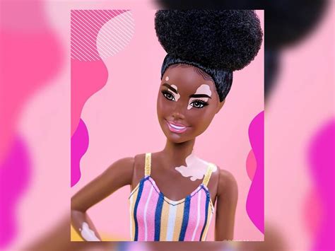 Barbies inclusivas ahora con prótesis y vitiligo El Resaltador