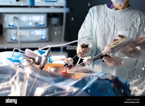 Selective Focus On The Hand Of A Surgeon With A Surgical Instrument